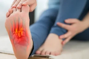 التهاب فاسیای کف پا